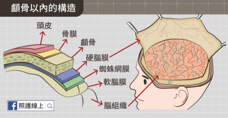 顱骨內部解剖圖－硬腦膜、蛛網膜與軟腦膜分層構造